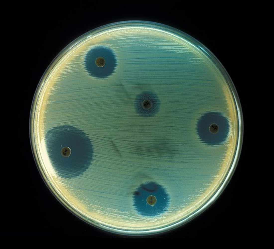 Wirkung eines Antibiotikums auf eine Bakterienkultur